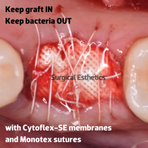 Cytoflex-SE PTFE membrane Surgical Esthetics