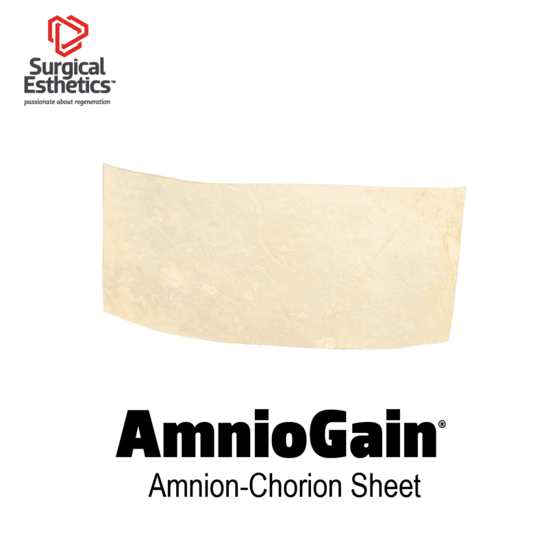 AmnioGain Amnion-Chorion Sheet